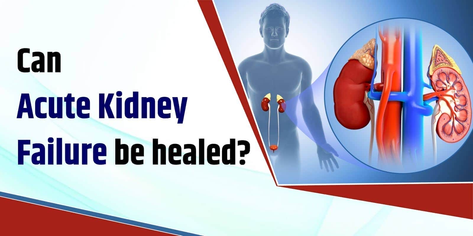 Can Acute Kidney Failure be healed?